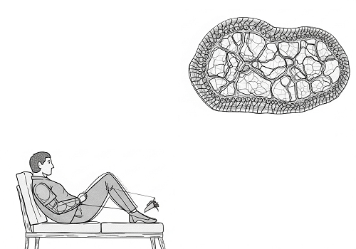 درمان سندروم پای بیقرار، خطر بالای بیماری پارکینسون رو کم میکنه درمان سندروم پای بیقرار، خطر بالای بیماری پارکینسون رو کم میکنه